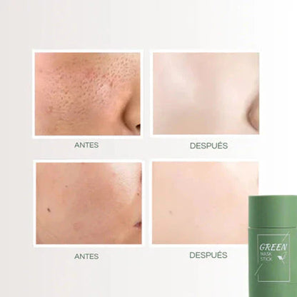 Mascarilla de Té Verde en Stick – ¡Paga 1 y Llévate 3!